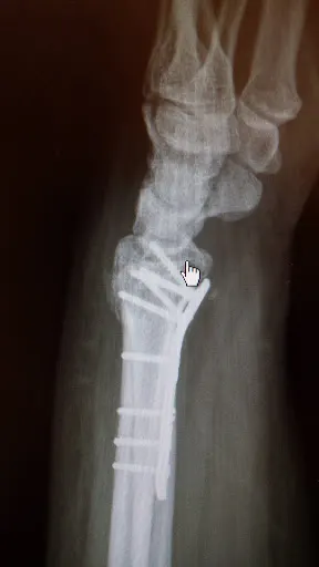 Poboży Tomasz dr nauk medycznych - Ortopeda prywatnie